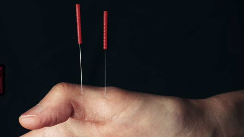 Formation Acupuncture Tung